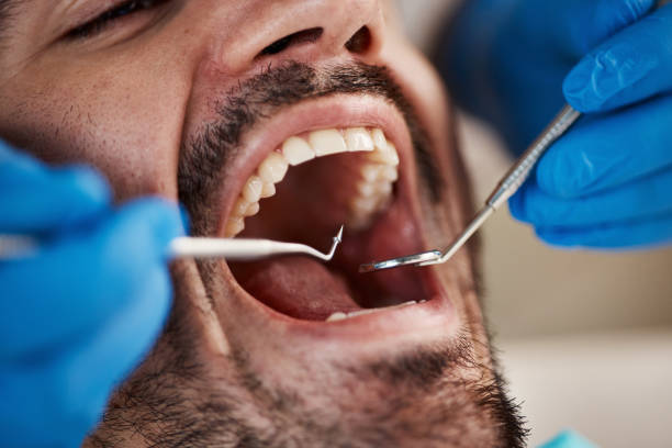 Best Wisdom Tooth Removal  in Kimberly, WI